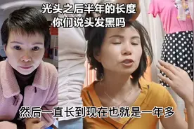 去年剃了光头之后，半年就是这么一个长度，你们觉得这头发黑吗
