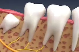 3D智齿的故事！视频封面