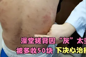 牛皮癣大姐澡堂搓背因皮屑太多被多收50块，受不了委屈下决心治癣视频封面