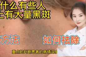 医学实录 一个脸部带有黑斑的女人 如何影响她的一生 如何祛除视频封面