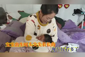 宝宝顺产时头被挤成尖尖的，现在一个月过去了，看看头好些了没有
