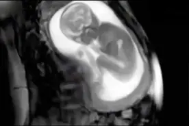 孕妈吃饭时，腹中宝宝会有哪些反应？一看就是个小吃货