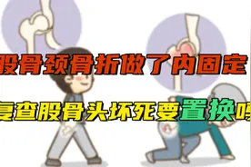 股骨颈骨折做了内固定，近期复查提示股骨头坏死，必须要置换吗？视频封面