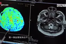 六旬老伯总犯困，一天能睡20个小时，竟是得了这种病|城事特搜视频封面