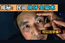 揭秘：农村挑牙虫和熏牙虫骗术，很多人被骗，其实原理很简单！视频封面