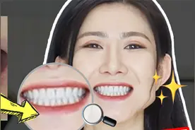 纯后天整白的！牙齿真能白，细节变美很重要！视频封面