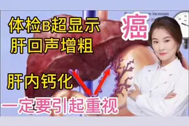 医院体检B超单 经常提示肝回声增粗 肝内钙化灶 纤维化 小心肝癌视频封面