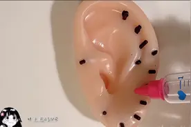 耳朵鼻子上的黑头去除过程，解压又好玩视频封面