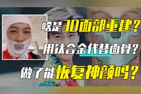 啥叫脸部3D重建？要用钛合金代替面骨？林志颖做了能恢复神颜吗？视频封面