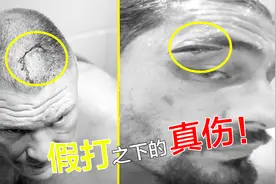 请别再讥讽WWE是假打！这些触目惊心的伤口可一点不“假”！视频封面