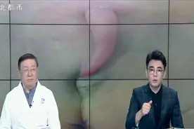 名医来了：小孩屁股上长尾巴是返祖？这很有可能是脊髓栓系综合症