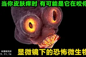 当你皮肤痒时，有可能是它在咬你视频封面