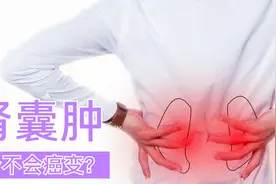 体检查出肾囊肿，如何知道是否会癌变？医生给您支招视频封面
