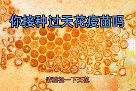天花的致命率请重视！你没接种疫苗吧？视频封面
