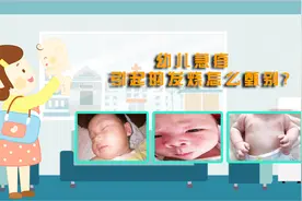 宝宝退烧出了一身红疹，急坏家长，幼儿急疹引起的发烧怎么甄别?