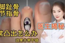 医生医学探秘 人体脚趾骨节指骨异常突出怎么办 医生利用手术修复视频封面