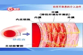 专家来了：血管疾病都包括哪些？听专家讲述死亡率极高的血管病症