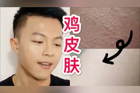 【七心】简单4步解决10年"鸡皮肤"和“后背痘痘”！