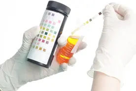 尿蛋白3+意味着什么？能彻底消除吗？中医：有视频封面