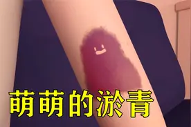 男孩手上的淤青，竟然变成了萌物，治愈动画《淤青》视频封面