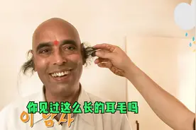 见过长耳毛的人吗？大叔的耳毛长达18厘米，太神奇了视频封面