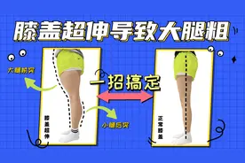 膝盖超伸导致的腿粗，大腿前突小腿后突，针对性的动作才能瘦腿