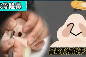 3D模拟隆鼻手术雕刻全过程，塌鼻梁变高鼻梁，效果好，看着疼！视频封面