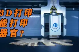 高科技带来福音！ 残疾不是终身病：3D打印骨头帮助人们重新行走视频封面