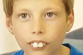 男孩长兔牙遭同学嘲笑，牙医给他整过之后，网友：这是整容吧？视频封面