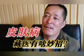 藏医治疗皮肤病有妙方，为啥用牛皮包裹全身，五味药做药浴？视频封面