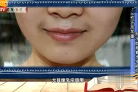 女性长“胡子”，汗毛加重？要注意，可能预示雌激素水平紊乱