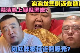 泡泡龙悲剧还在继续？大蒜涛脸上疑现黑斑？网红胖猴仔近照曝光？
