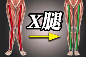 X型腿自救训练，每天一遍，轻松矫正X型腿视频封面