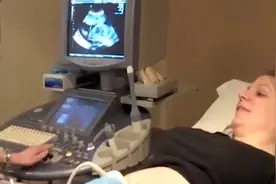 美女怀孕做B超，肚中却惊现一条“狗”，真相让医生傻眼视频封面