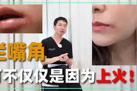 烂嘴角不是上火那么简单！医生支招，这么做缓解效果特别好视频封面