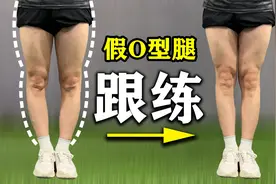 假性O型腿矫正训练，每天一遍，两周见效视频封面