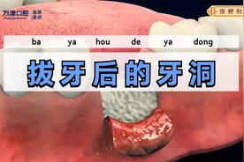 拔完大牙剩下的洞怎么办？视频封面