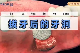 拔完大牙剩下的洞怎么办？视频封面