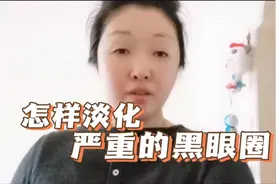 有严重的黑眼圈怎么办？两个简单又省钱的好方法，轻松淡化黑眼圈视频封面