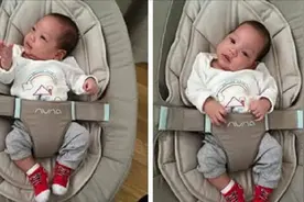 未满月宝宝颈部突起，硬得像骨头，送医体检时医生诊断是斜颈