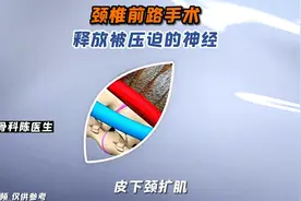 颈椎前路手术释放被压迫的神经！视频封面