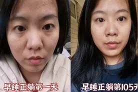 女子坚持286天10点早睡，前后对比惊人：泪沟法令纹都变浅了视频封面