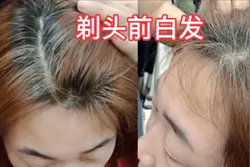 48岁姐姐剃光头前白发是这样的,后来剃了光头长出来头发又好黑视频封面
