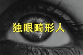 独眼的畸形婴儿真的存在！视频封面