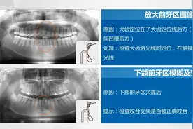 【口腔放射2】CBCT拍摄影像定位视频封面