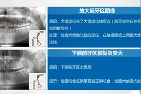 【口腔放射2】CBCT拍摄影像定位视频封面