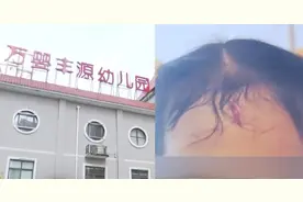 4岁女童幼儿园额头磕出“第三只眼”，园长：一点小伤狮子大开口