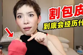 割包皮到底会经历什么？全网保姆级干货都在这里！｜丁丁历险记2视频封面
