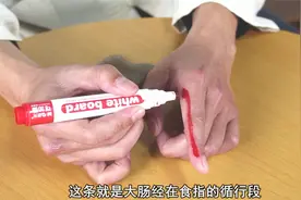 上火便秘，肛门灼热，找到这1个位置，刮5分钟，专泻大肠热