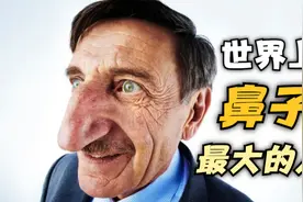 8.8cm！土耳其男子蝉联世界鼻子最大的人视频封面